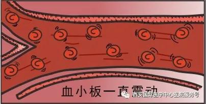 血小板是正常值的三倍？專家提醒小心血栓和出血！