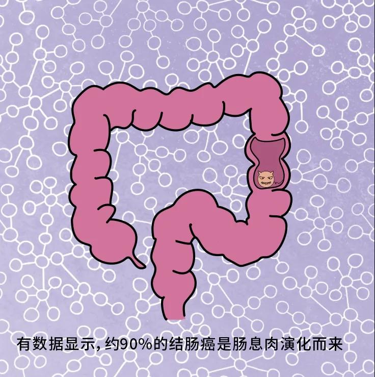 奪走“黑豹”生命的結(jié)腸癌，到底什么來頭？