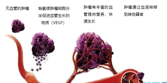 晚期腫瘤為什么會復(fù)發(fā)轉(zhuǎn)移？