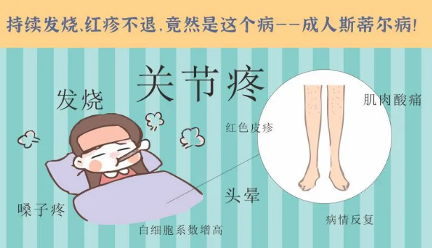 持續(xù)發(fā)燒、紅疹不退……她終于在這里治好了這個(gè)罕見病