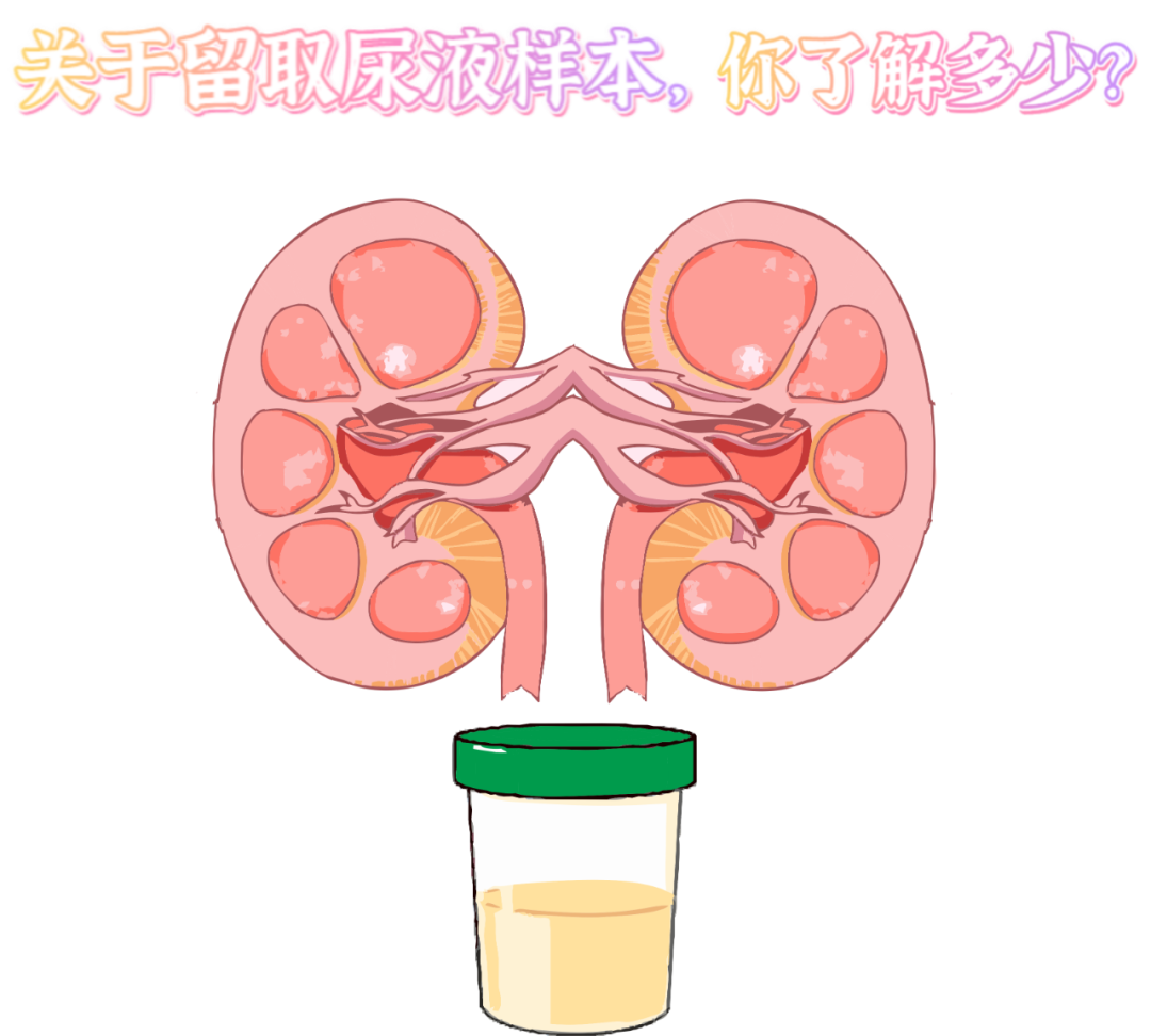 做尿檢，不得不說的注意事項(xiàng)！