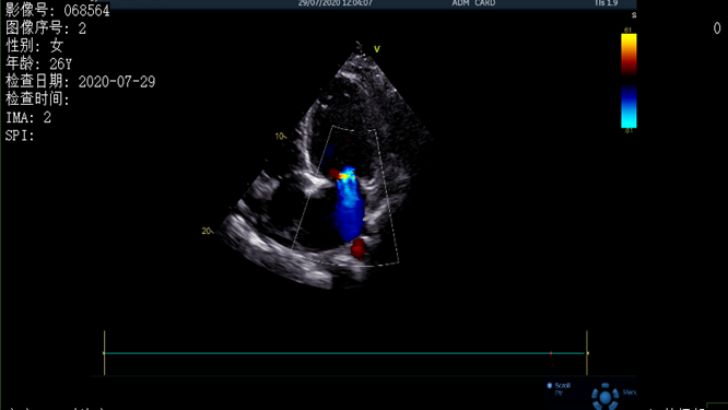 心電圖異常，心臟卻沒事，罪魁禍?zhǔn)资恰?>
				             </a>
                <div   id=
