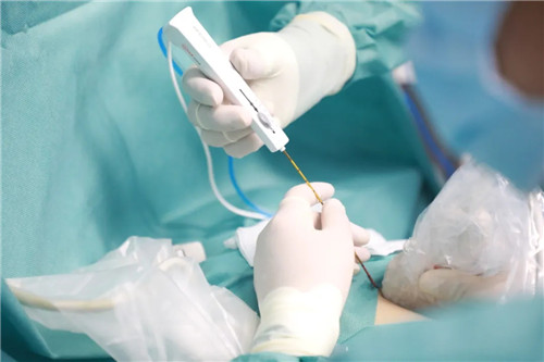 針尖上的絕絕子①｜從重慶到西安，23歲的姑娘只為了這件事……周曉東和他的超聲團隊