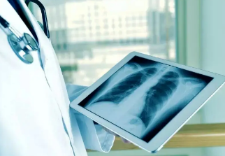 健康呼吸④體檢發(fā)現(xiàn)肺結(jié)節(jié)，我該怎么辦？