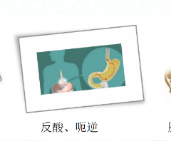 關(guān)愛身體健康，輕松檢查胃腸