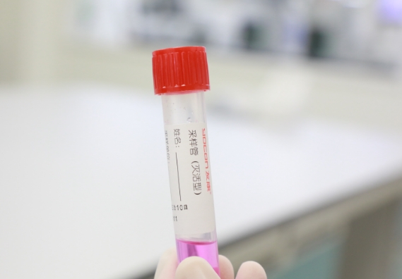 支原體感染檢測(cè)手段知多少？