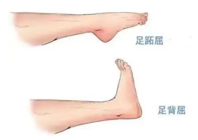 扭胯小連步、動感搖花手……“科目三”雖火，運動損傷也要防！